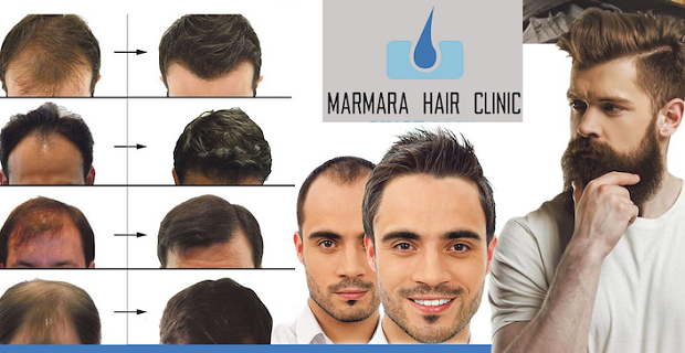 Saç Ekiminde Uzman Marmara Hair Clinic